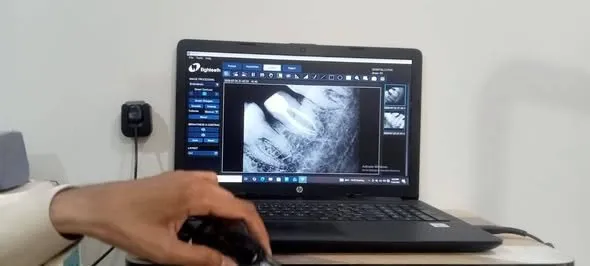 Dental x-ray - photo 3