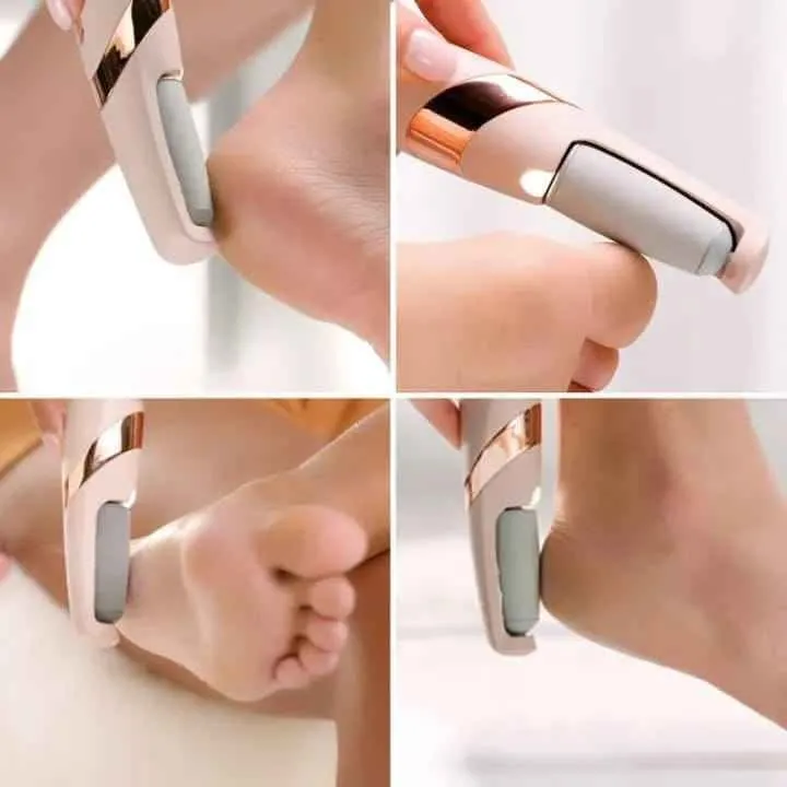 Electric foot grinder - photo 3