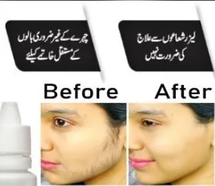 Permanent Hair Removal Lotion - photo 2